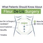 What Patients Should Know About Fleur De Lis Surgery